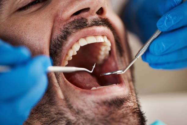 Best Tooth Infection Emergency Dentist  in Searingtown, NY